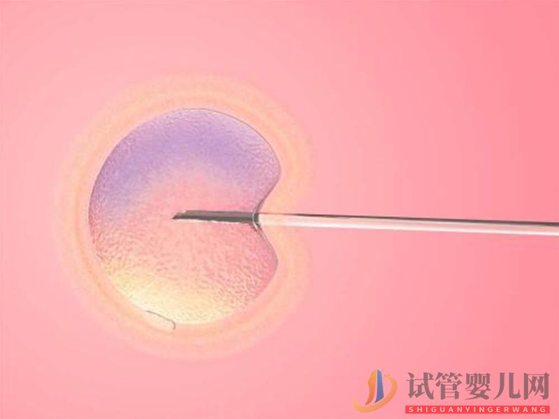 什么是PGS和PGD 它在三代試管中有哪些作用? 什么是PGS和PGD 它在三代試管中有哪些作用?(圖2)