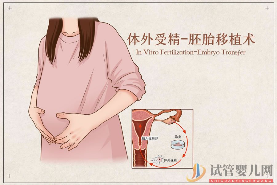 試管嬰兒（體外受精－胚胎移植技術）