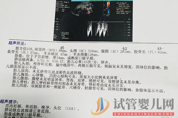 男孩女孩雙頂徑對照表(圖2) 男孩女孩雙頂徑對照表(圖2)