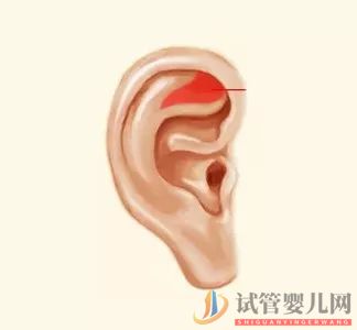 耳朵長(zhǎng)這樣的人更長(zhǎng)壽，這次中西醫(yī)觀點(diǎn)一致(圖6)