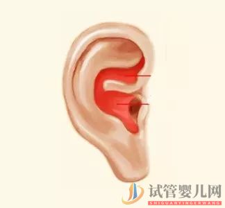 耳朵長(zhǎng)這樣的人更長(zhǎng)壽，這次中西醫(yī)觀點(diǎn)一致(圖5)