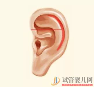 耳朵長(zhǎng)這樣的人更長(zhǎng)壽，這次中西醫(yī)觀點(diǎn)一致(圖7)