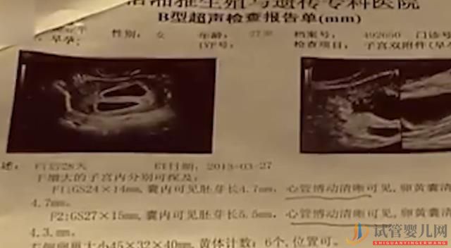 妻子偷偷做試管嬰兒,懷孕8月想給丈夫驚喜,沒想到丈夫卻要離婚(圖2)