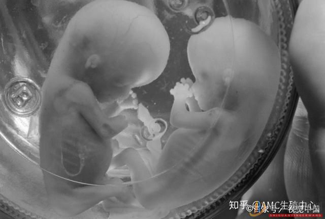 試管嬰兒和普通嬰兒有什么區(qū)別(圖5) 西昌試管嬰兒和普通嬰兒有什么區(qū)別(圖5)