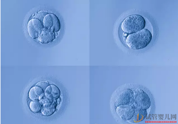 試管嬰兒能做幾次？試管嬰兒多少錢(圖1)