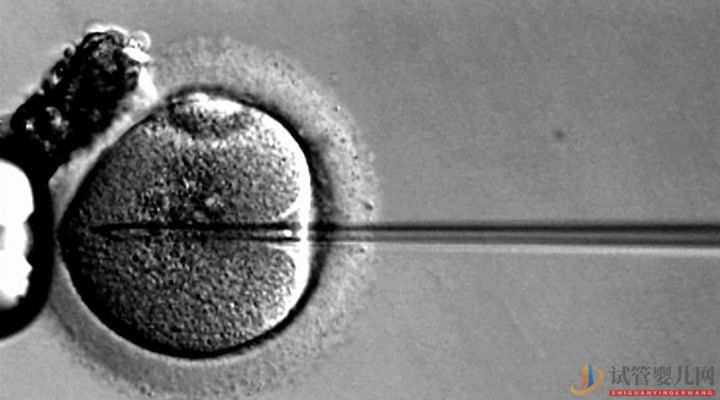 試管嬰兒可以報銷了,你可能需要這篇輔助生(圖11) 試管嬰兒可以報銷了,你可能需要這篇輔助生(圖7)
