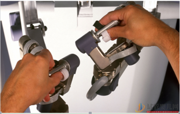 南昌達芬奇機器人做減重手術費用高，效果好嗎？(圖2)