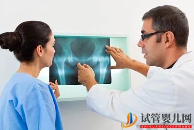 太原強直性脊柱炎治療費用大概多少_醫生是這樣說的(圖1)