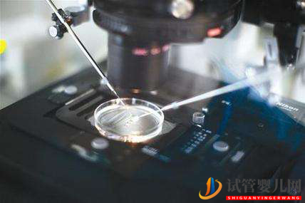 試管胚胎移植過程中要注意的六個問題(圖1)