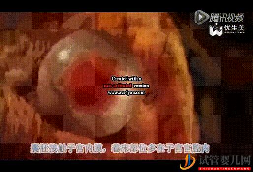 超真實全記錄視頻,揭秘胚胎著床(圖10) 超真實全記錄視頻,揭秘胚胎著床(圖4)