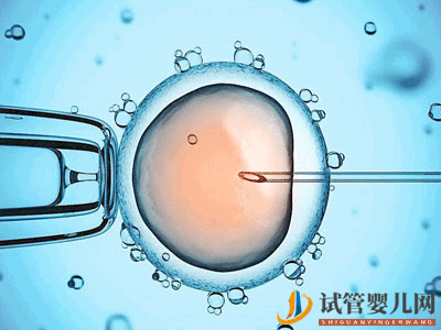 淄博試管嬰兒流程中,取卵并不是最疼的那一個!(圖2)