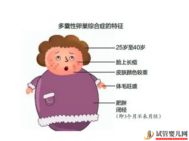 多囊患者可以做試管嬰兒嗎？試管成功率大嗎？(圖1)