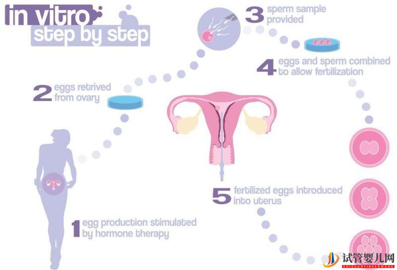 試管嬰兒全過程是怎樣的？什么是試管嬰兒？(圖1)