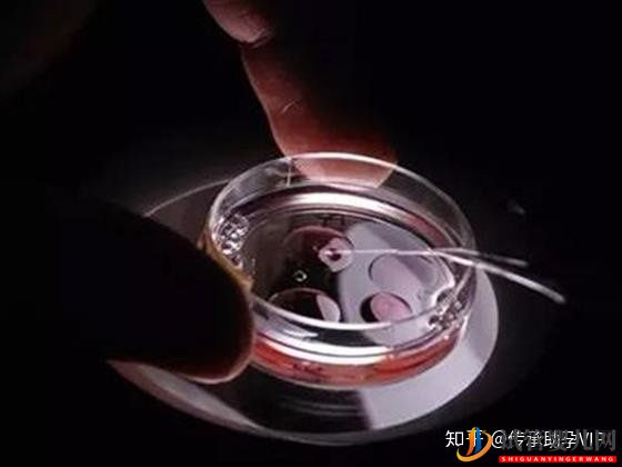 烏海試管嬰兒全過程需要多少時間(圖2)