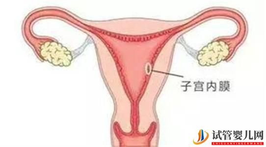做俄羅斯試管嬰兒需要調理內膜嗎？調內膜一般要多少天(圖1)