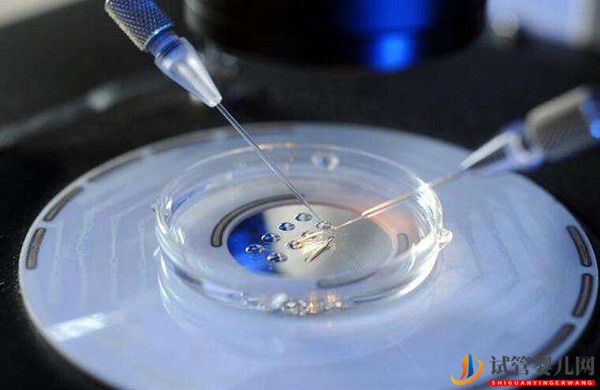 俄羅斯試管嬰兒養(yǎng)囊胚是怎樣的？(圖1)