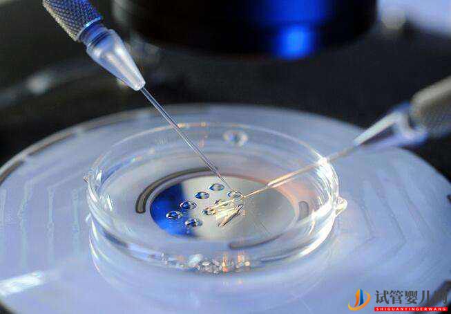 女人做試管嬰兒取卵痛嗎女人做了試管人就廢了嗎(圖1)