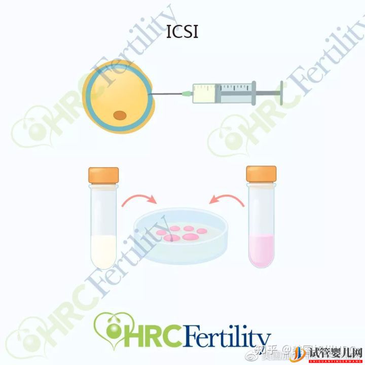 原來美國試管是這樣的美國試管(圖7) 原來美國試管是這樣的美國試管(圖7)