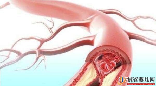 美國試管專家講解_人工授精和試管嬰兒的區(qū)別(圖21) 美國試管專家講解人工授精和試管嬰兒的區(qū)別(圖11)