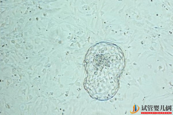 美國試管嬰兒囊胚培養優勢-養囊率高低取決于什么？(圖1)