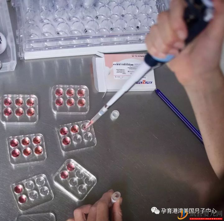 試管嬰兒技術(shù),美國(guó)vs中國(guó)(圖8) 試管嬰兒技術(shù),美國(guó)vs中國(guó)(圖4)