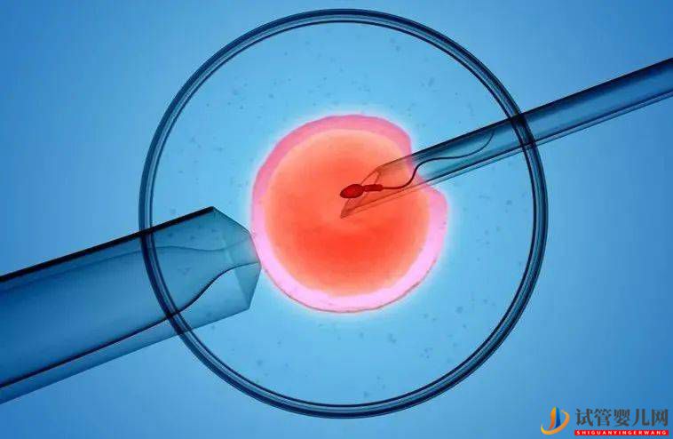 泰國(guó)試管成功率高的原因竟然是?(圖1) 泰國(guó)試管成功率高的原因竟然是?(圖1)