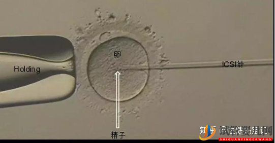 第三代試管嬰兒費用是多少,大致的流程有哪些(圖3) 銅仁第三代試管嬰兒費用是多少,大致的流程有哪些(圖2)