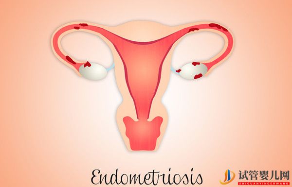 子宮內膜厚度對美國試管嬰兒移植的影響，如何保養？(圖1)