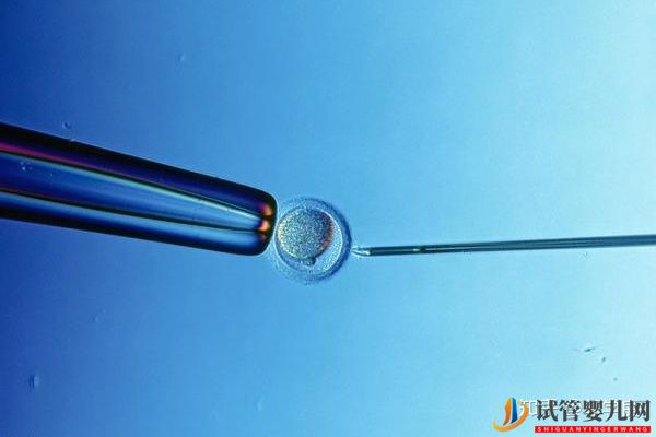 美國試管嬰兒方案制定依據各環節具體操作及重點(圖2)