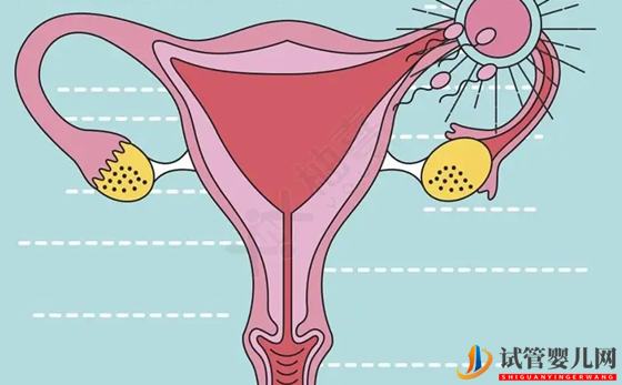 ()@%U5{27XBYAF~Y}@YZCAS.png 雙側(cè)卵巢多囊能懷孕嗎 雙側(cè)卵巢多囊原因是什么(圖1)