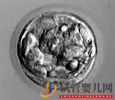 美國試管嬰兒_這樣的囊胚才是極好的(圖8)