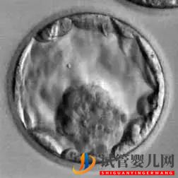 美國試管嬰兒_這樣的囊胚才是極好的(圖21)