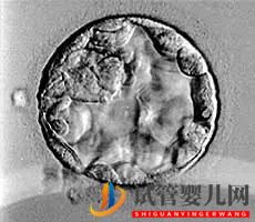 美國試管嬰兒_這樣的囊胚才是極好的(圖18)