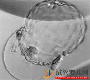 美國試管嬰兒_這樣的囊胚才是極好的(圖26)