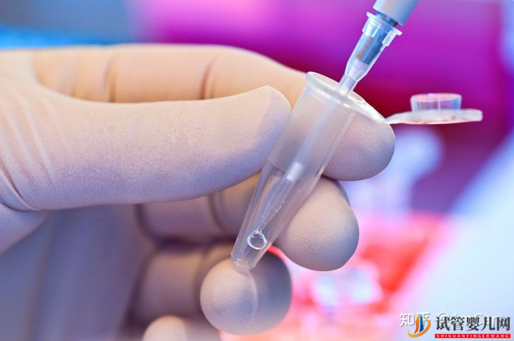 試管嬰兒大揭秘,取卵疼不疼(圖4) 試管嬰兒大揭秘,取卵疼不疼(圖4)