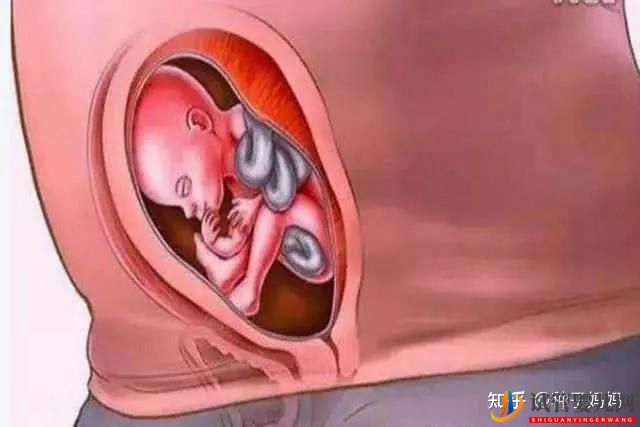 經痛赴美國做試管嬰兒有影響嗎__云南試管嬰兒價格(圖12) 經痛赴美國做試管嬰兒有影響嗎(圖6)