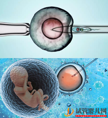 第三代試管嬰兒的利弊有哪些?(圖1) 第三代試管嬰兒的利弊有哪些?(圖1)
