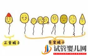 夫妻染色體正常,但胚胎染色體異常,什么原因引起(圖4)