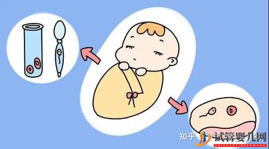 很多人有顧慮_試管嬰兒出生的寶寶和自然懷孕的寶寶(圖1)