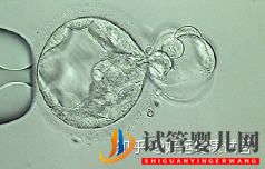 三代試管知男女的必經之路—胚胎活檢術(圖4)