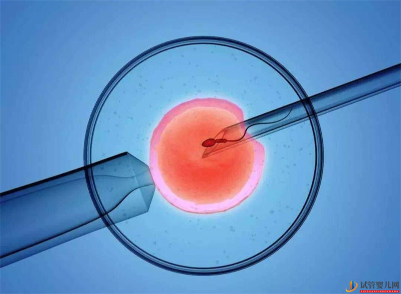 做試管嬰兒一般要多少錢？(圖1)
