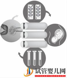 專家澄清滬首例第三代試管嬰兒不涉及胎兒性別(圖1)