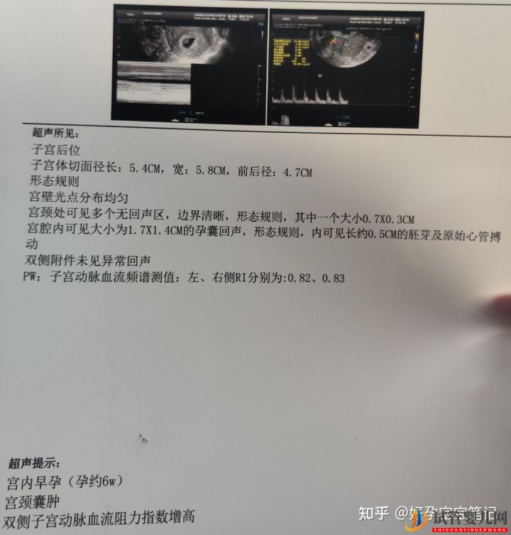 25歲就走上非常艱辛的試管嬰兒求子之路,感恩志愿者(圖2)