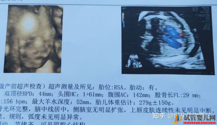 25歲就走上非常艱辛的試管嬰兒求子之路,感恩志愿者(圖4)