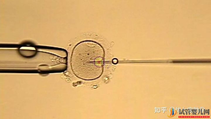 全面解析第三代試管嬰兒的科普知識(圖12)