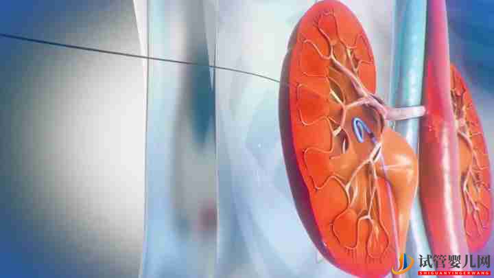 醫(yī)學三維動畫可以解決哪些問題(圖1)