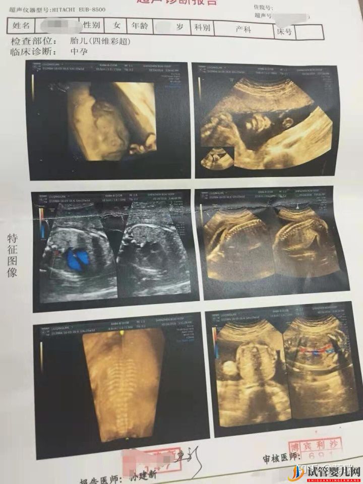 我終于懷上了!辛酸三代試管經(jīng)歷!大家接好孕!(圖1)