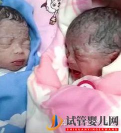 試管嬰兒網(wǎng):一個高齡婦女的試管之路(三次取卵兩次移植的龍鳳胎...(圖9) 一個高齡婦女的試管之路(圖5)