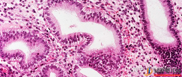 試管嬰兒網(wǎng):人工雙胞胎的費(fèi)用多少,雙胞胎的幾率有多大(圖5) 人工雙胞胎的費(fèi)用多少,雙胞胎的幾率有多大(圖3)