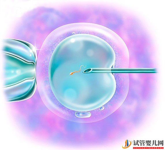 一、二、三代試管嬰兒的優缺點,做試管嬰兒應該選擇(圖2)